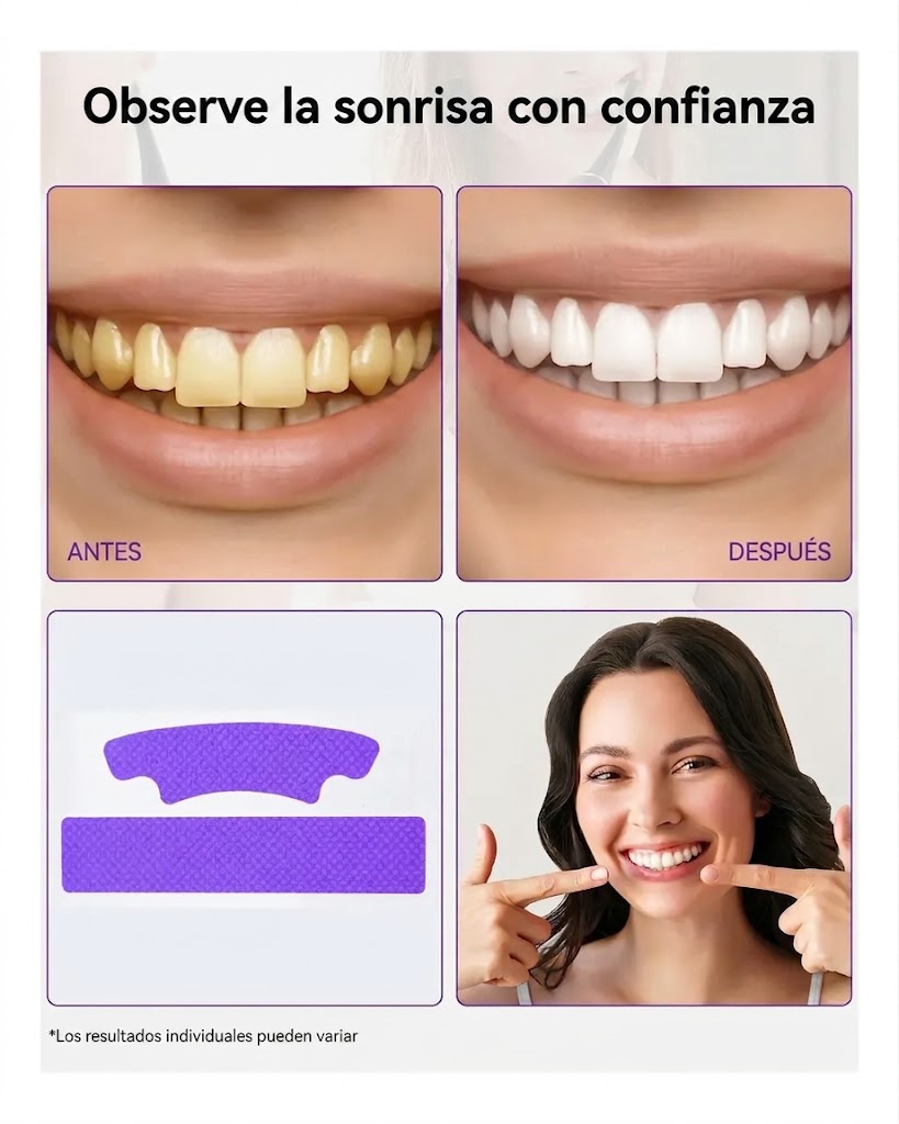 Kit Blanqueador Dental Nácar – 7 sesiones