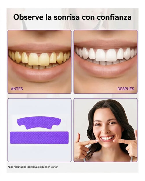 Kit Blanqueador Dental Nácar – 7 sesiones